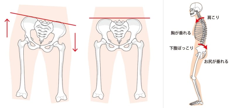 無料素材 治療院の産後骨盤矯正で使える写真 イラストサイト一覧